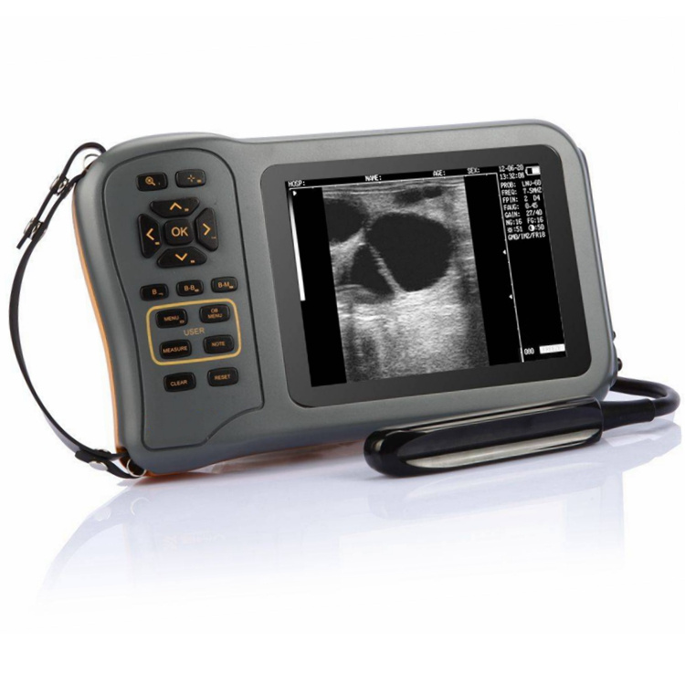 V3 Handheld B/W Ultrasound Scanner