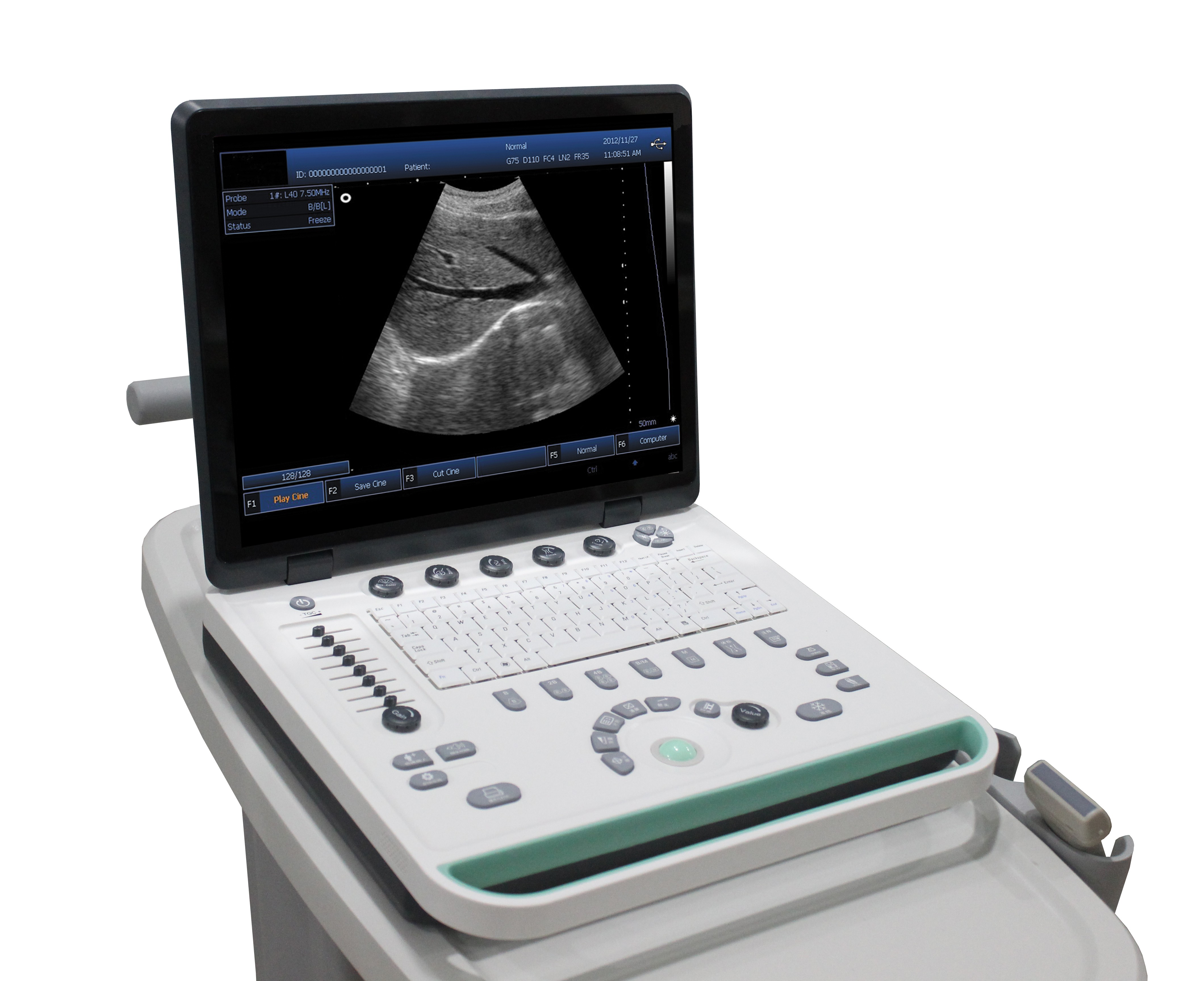 DP-50 Laptop B/W Ultrasound Scanner