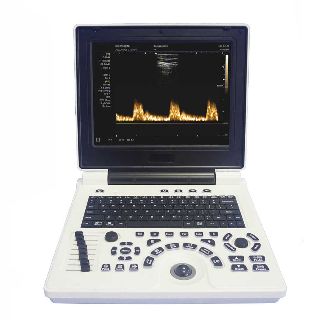 DP-10 Digital Ultrasound Scanner