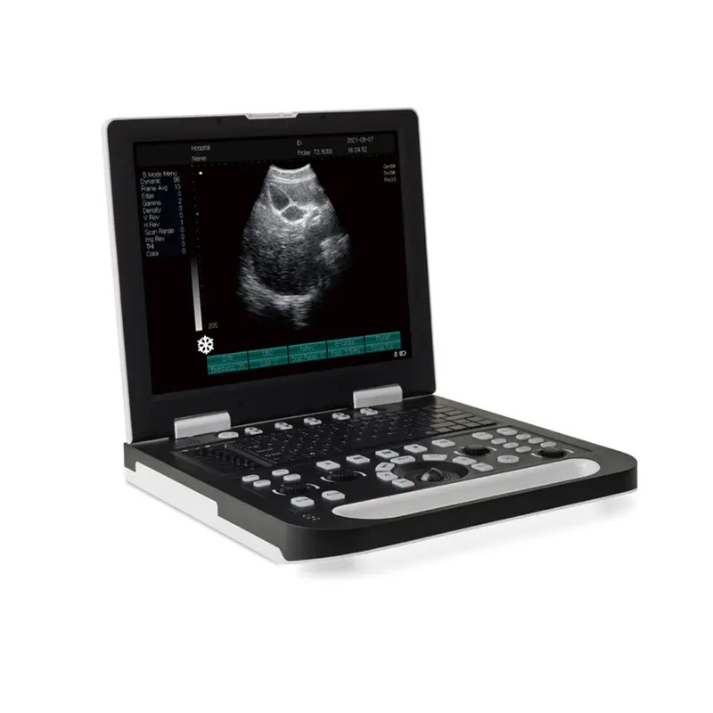 DP-50 Plus Laptop Ultrasound Scanner