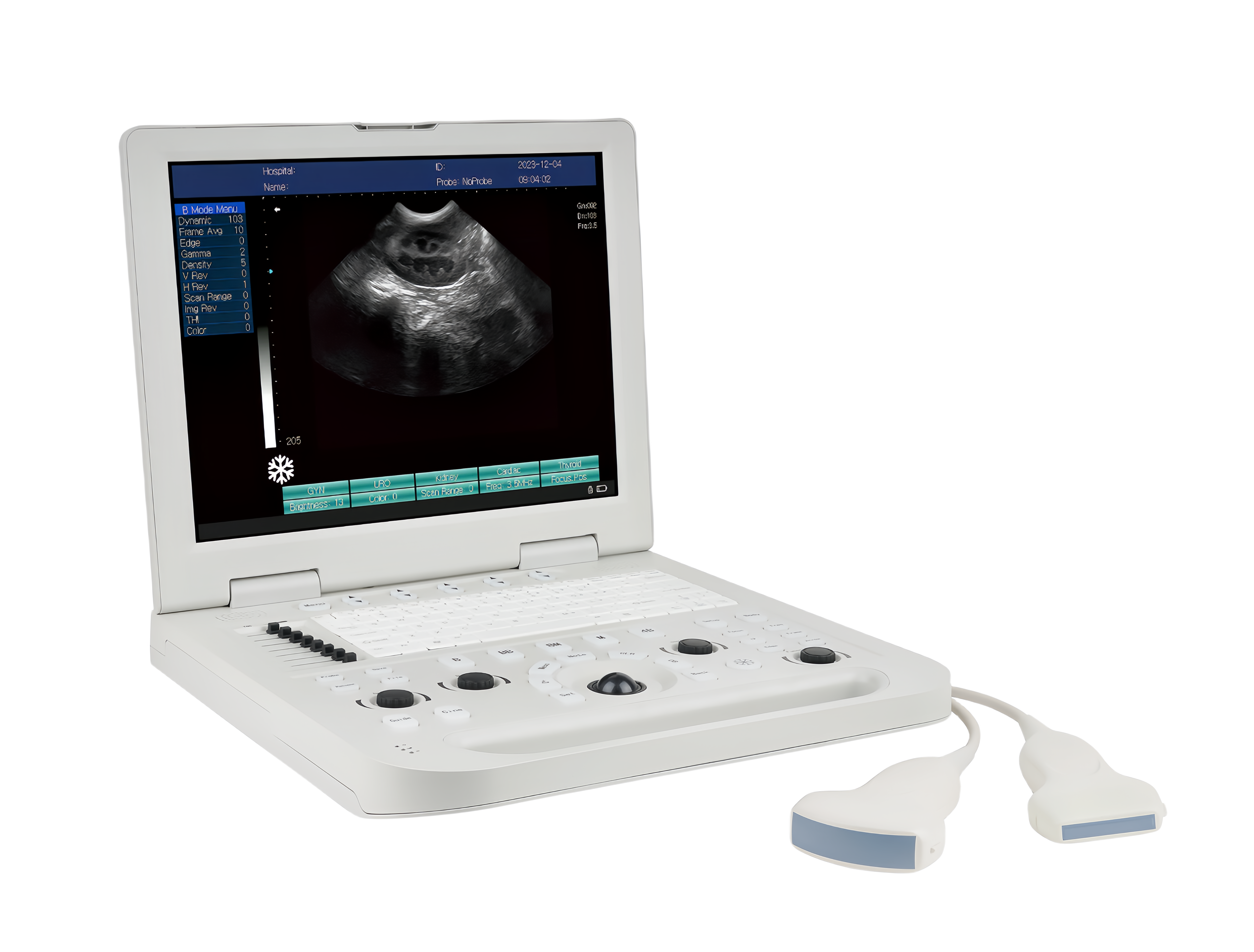 Laptop Ultrasound Scanner DP-50A
