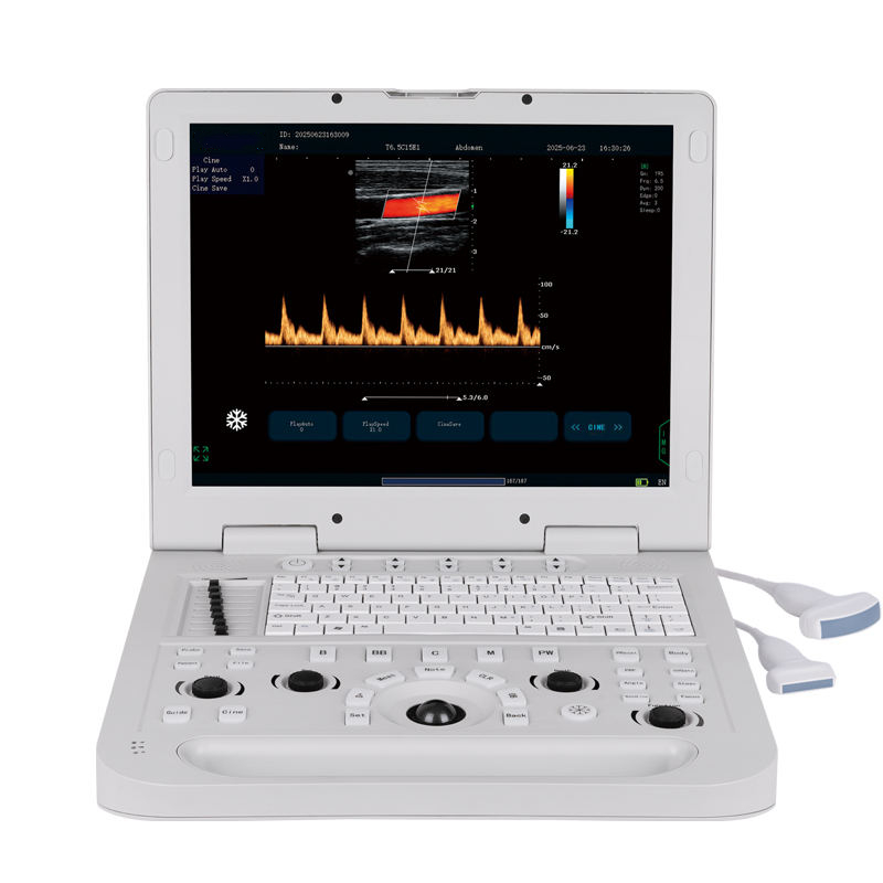  M6A Laptop Portable  Color Doppler