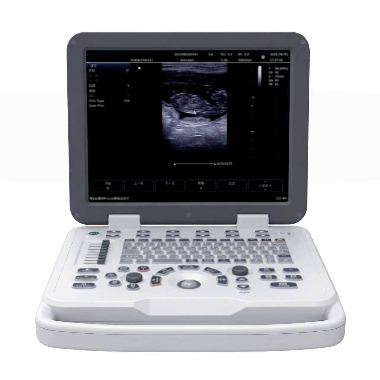 DP-50B Portable Black & White Ultrasound System